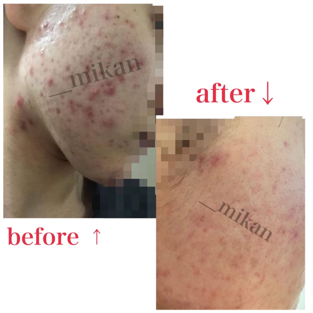 モイスチャージェル1/エンビロン/フェイスクリームを使ったクチコミ(1枚目)