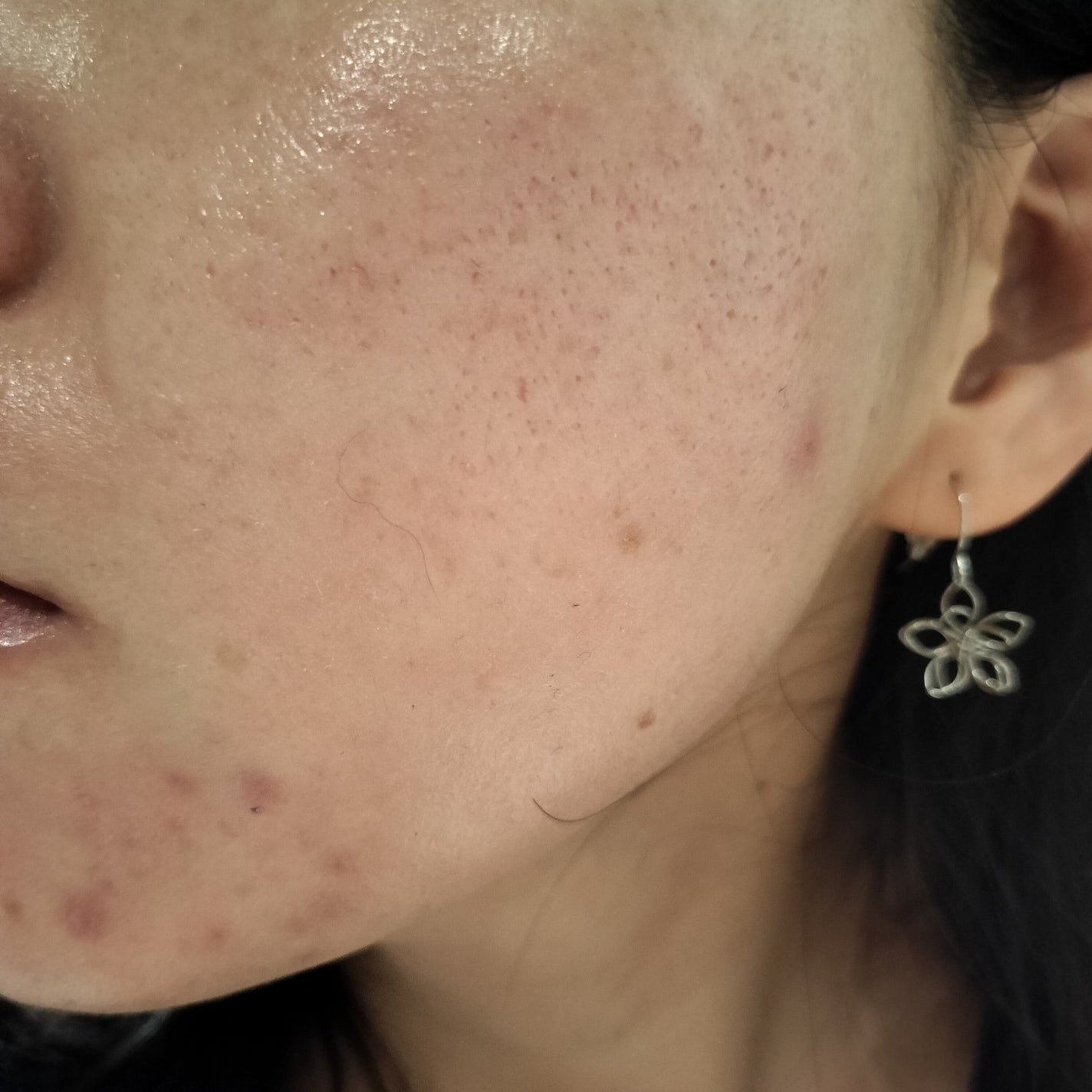 miina@汚肌工事録⚠️ on LIPS 「2024/01/03の#汚肌工事録おはようございます☀昨日の夜..」(2枚目)