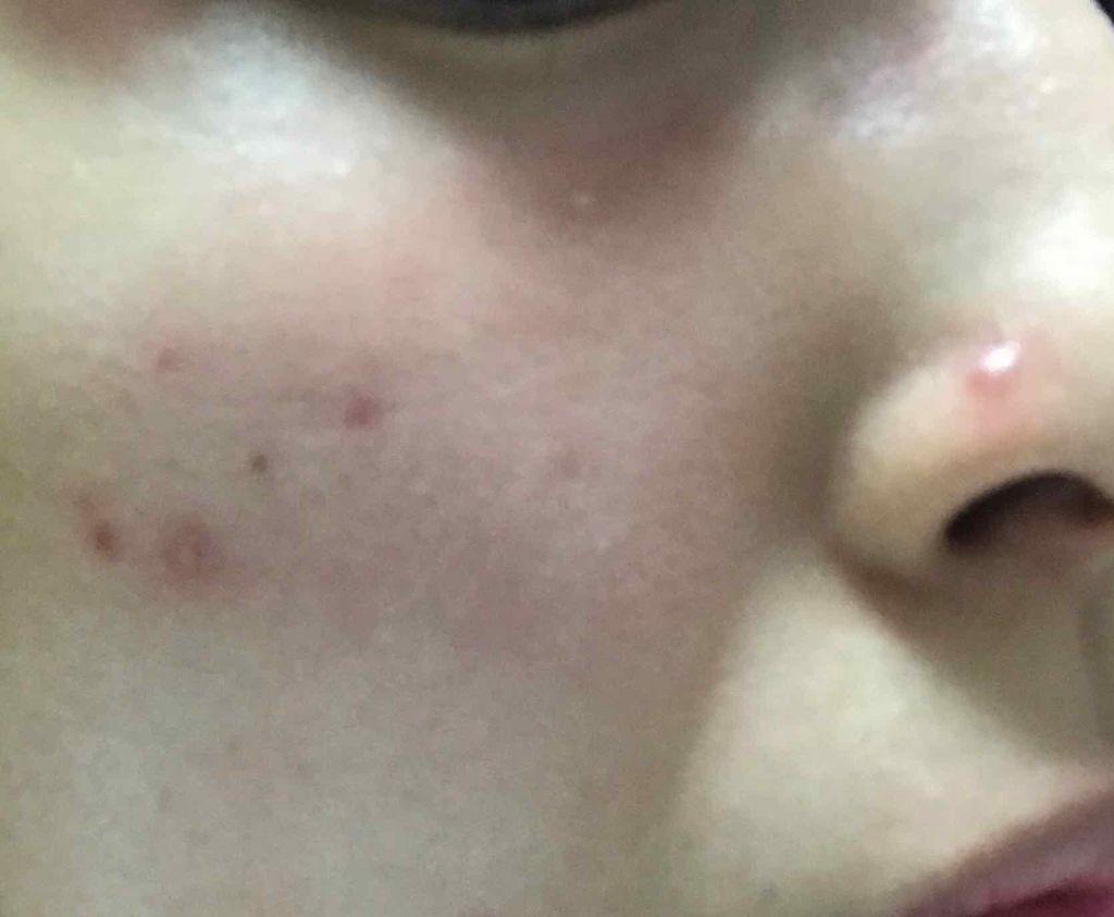 オリーブヤング ケアプラス/Olive Young/その他を使ったクチコミ（2枚目）