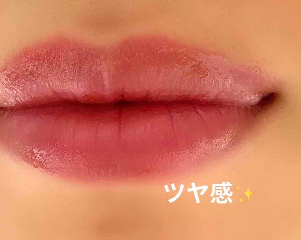 モアリップ N (医薬品)/資生堂薬品/その他を使ったクチコミ(3枚目)