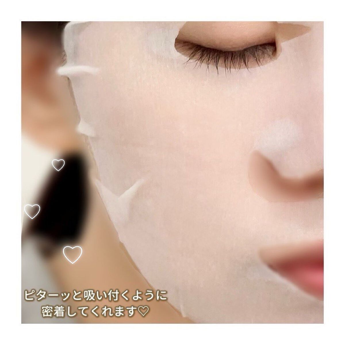 ルルルン ハイドラ V マスク/ルルルン/シートマスク・パックを使ったクチコミ(6枚目)