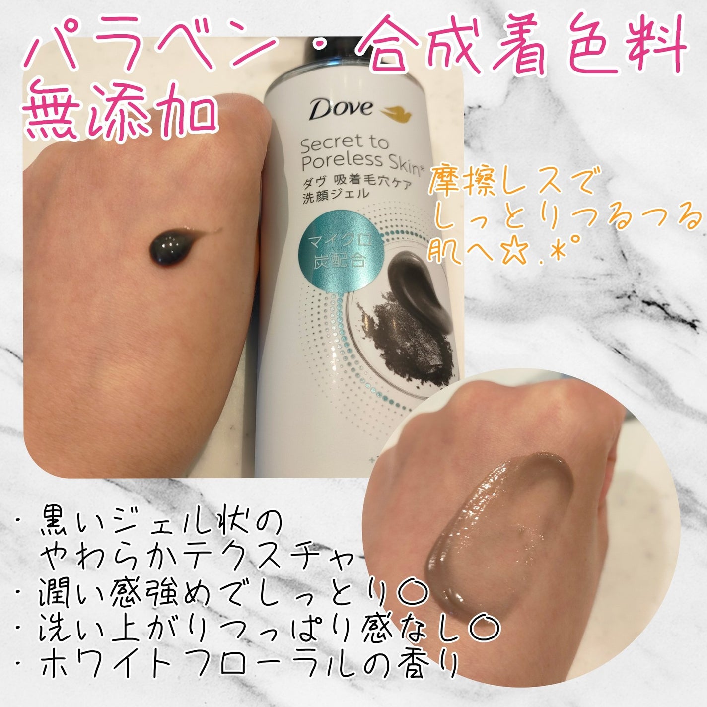 ã㎠åžçæ¯ç©Žã±ã¢ æŽé¡ãžã§ã«/ããŽ/ãã®ä»æŽé¡æã䜿ã£ãã¯ãã³ãïŒ2æç®ïŒ