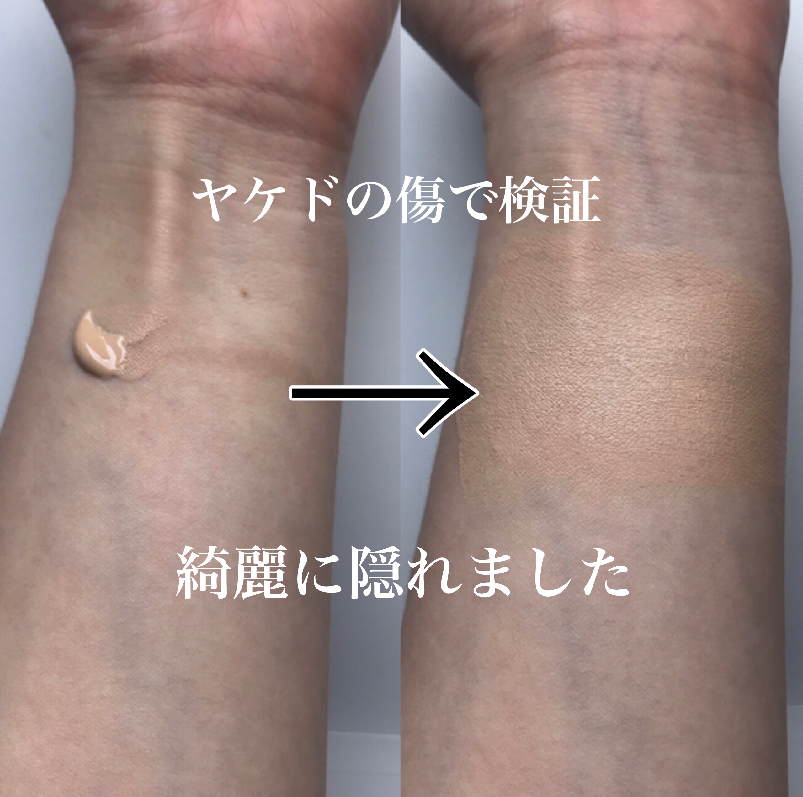 マーシュフィールド SC ボディカバーファンデN/マーシュ・フィールド/クリーム・エマルジョンファンデーションを使ったクチコミ（3枚目）