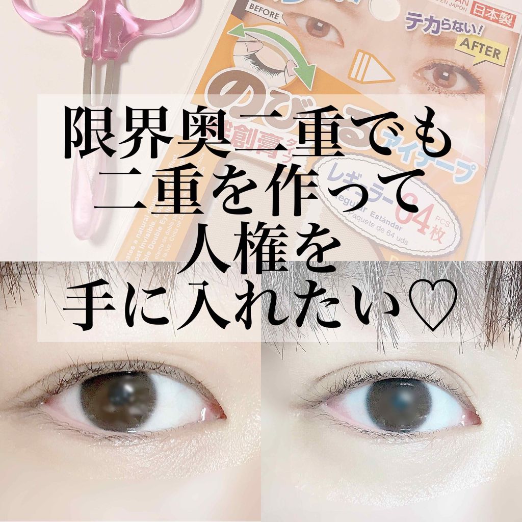 アイテープ(絆創膏タイプ、レギュラー、70枚)/DAISO/二重まぶた用アイテムを使ったクチコミ(1枚目)
