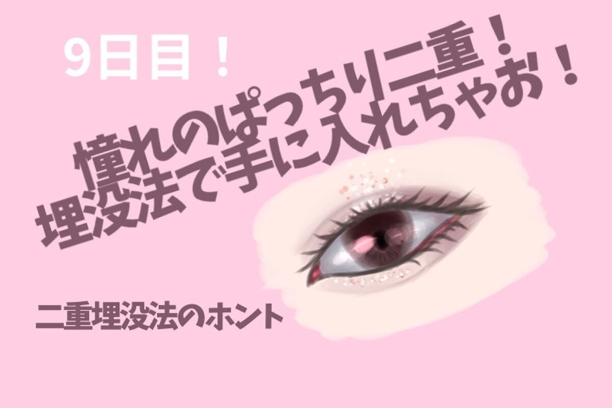 ししっぴ。フォロバはお任せください💕 on LIPS 「ししっぴ。の二重埋没法ダウンタイム公開日記です✨こんにちは!し..」(1枚目)