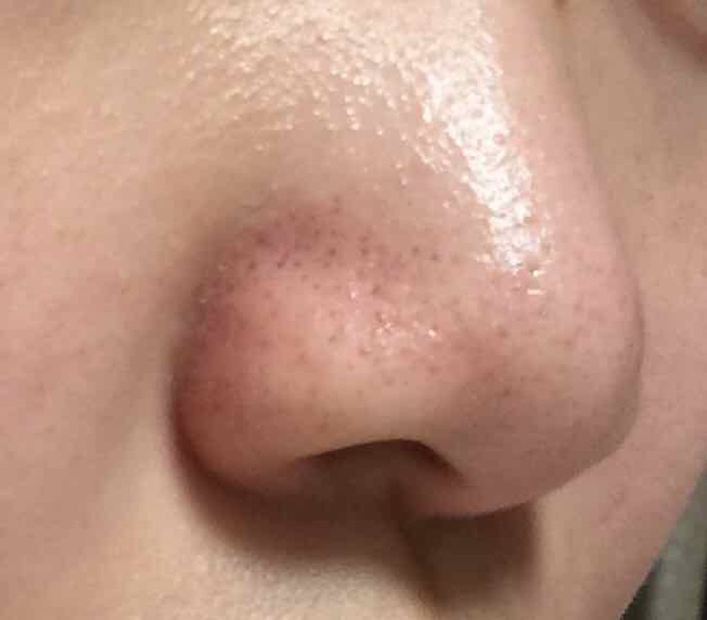 マイルドクレンジング オイル/ファンケル/オイルクレンジングを使ったクチコミ(3枚目)