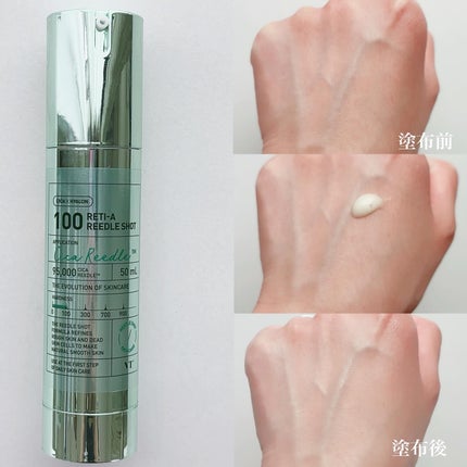 シカレチA エッセンス0.1/VT/美容液を使ったクチコミ(5枚目)