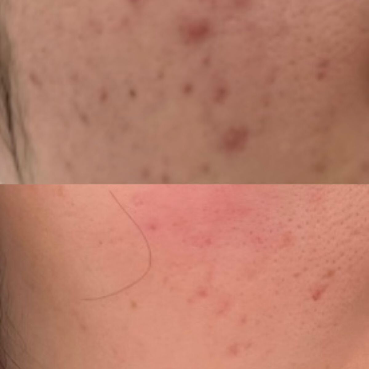 ゆ on LIPS 「投稿見て下さりありがとうございます。私が中学校の頃から悩み続け..」(2枚目)