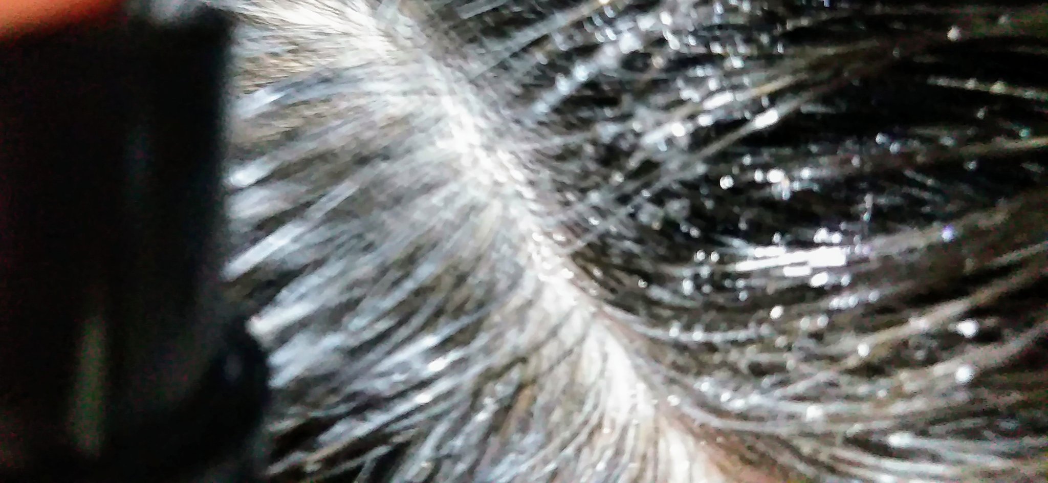 薬用スカルプセラム/wicot/頭皮ローションを使ったクチコミ（3枚目）