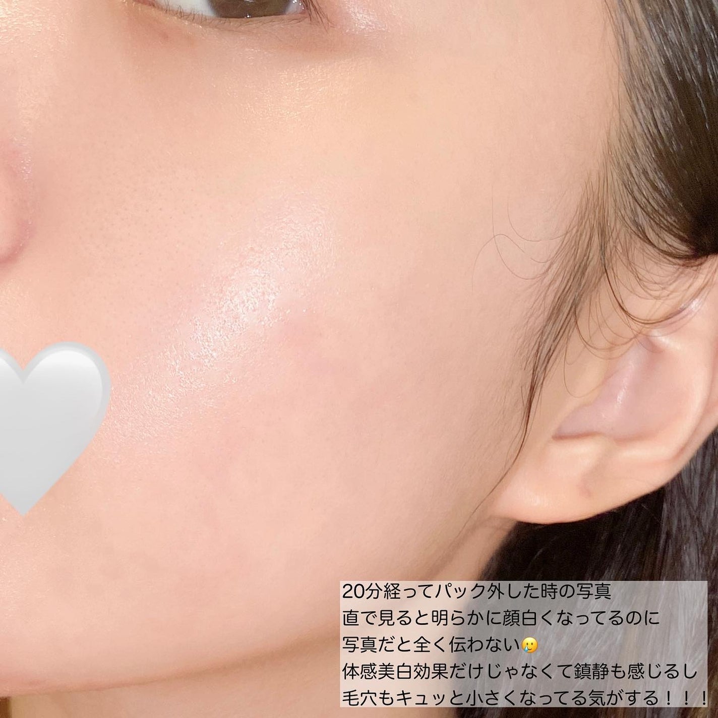 リアルマスクパック/SOME BY MI/シートマスク・パックを使ったクチコミ(4枚目)