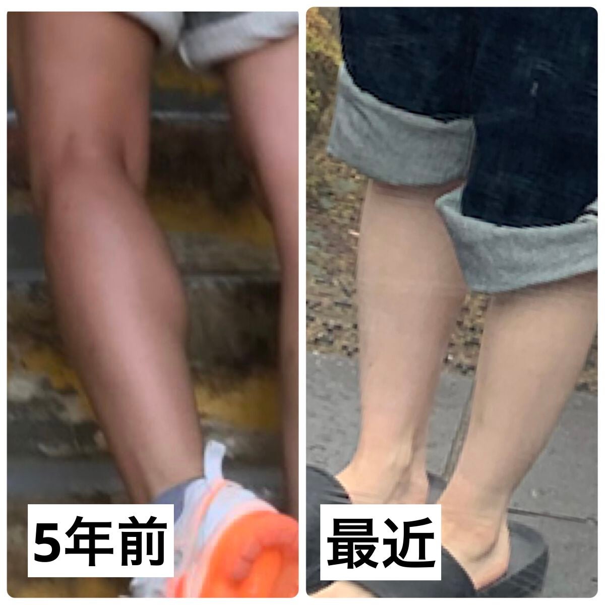 シナールLホワイト エクシア(医薬品)/シオノギ製薬/その他を使ったクチコミ(3枚目)