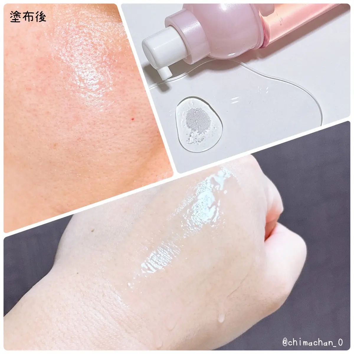 モイストケア ローション MB/d プログラム/化粧水を使ったクチコミ（2枚目）