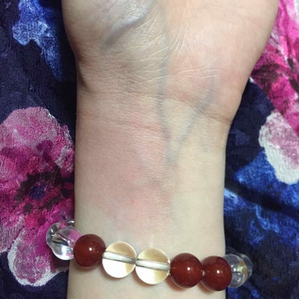 ムヒパッチA(医薬品)/ムヒ/その他を使ったクチコミ(3枚目)