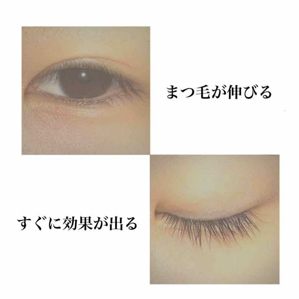 ローヤルゼリー配合 栄養ローション/DAISO/美容液を使ったクチコミ(1枚目)