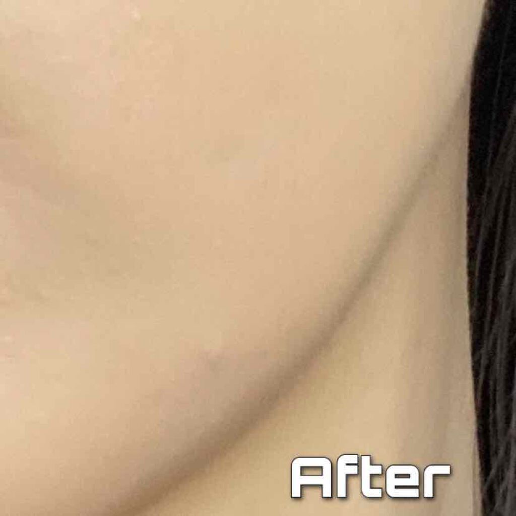 レッドコンシーラー/MEDICUBE/リキッドコンシーラーを使ったクチコミ(3枚目)