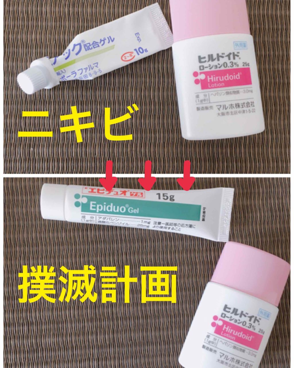 エピデュオゲル/マルホ株式会社/その他を使ったクチコミ（1枚目）