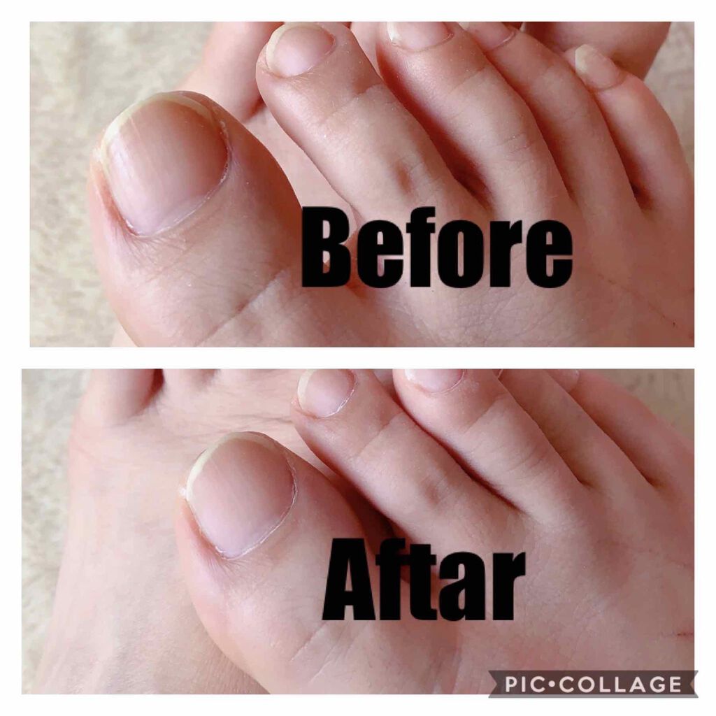 スポンジバッファ ハーフムーン型/デュカート/ネイル用品を使ったクチコミ（3枚目）