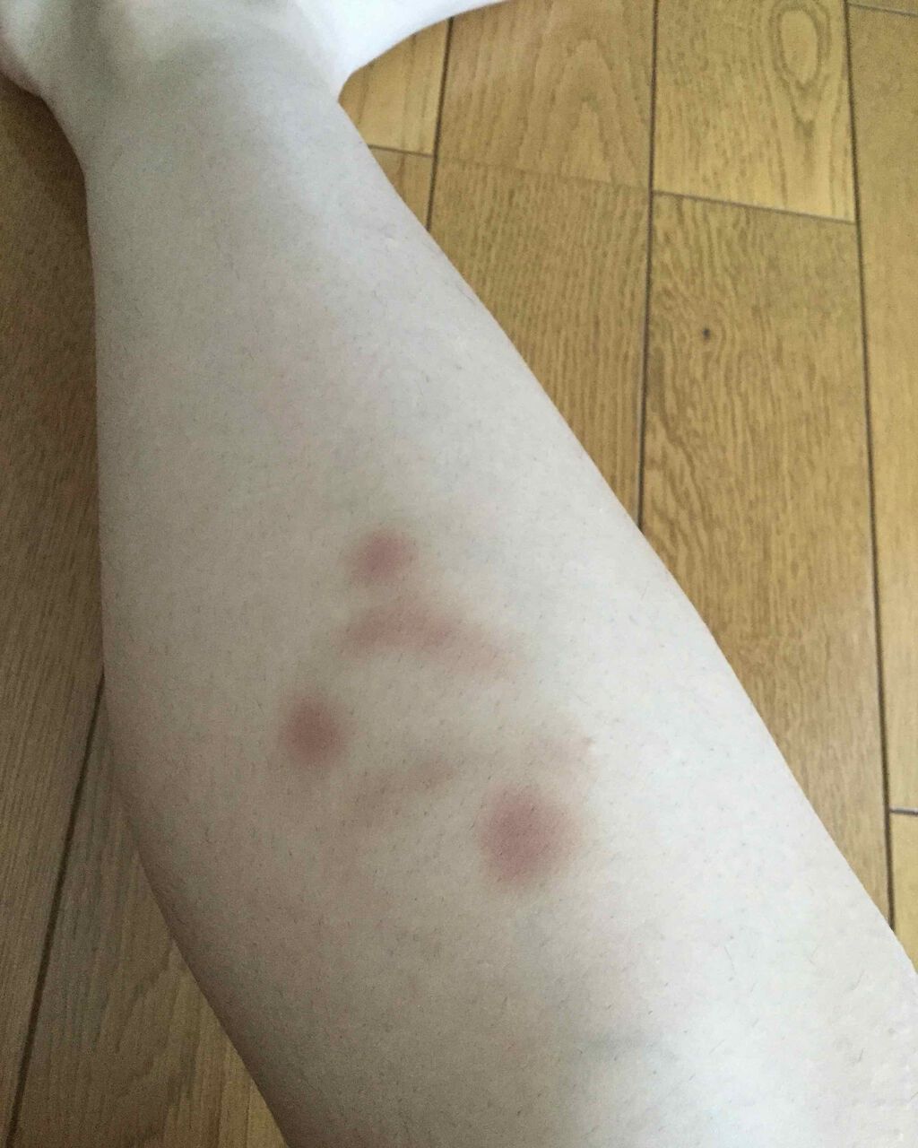 あらぽん on LIPS 「こんにちはヽ(^0^)ノあらぽんです。近況報告①から2週間が経..」(2枚目)