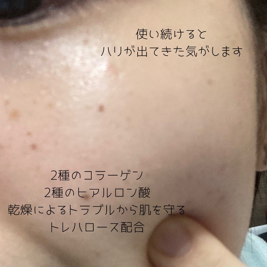 薬用ホワイトソリューションEX/ドクターベルツ/化粧水を使ったクチコミ(4枚目)