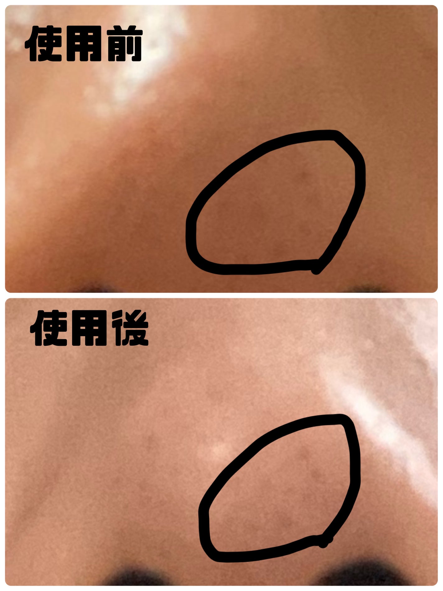 アリウルアップルサイダーディープクレンジングオイル/Ariul/オイルクレンジングを使ったクチコミ(2枚目)