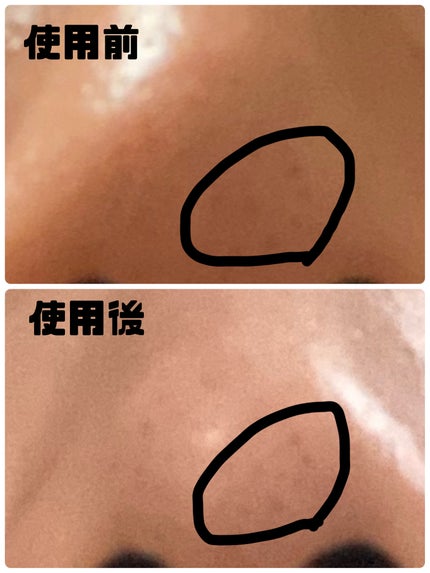 アリウルアップルサイダーディープクレンジングオイル/Ariul/オイルクレンジングを使ったクチコミ(2枚目)