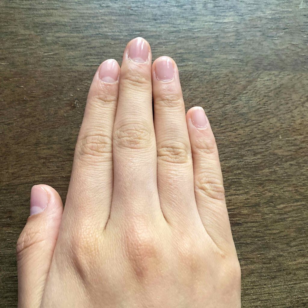 にたまご on LIPS 「4日目!やっぱり爪の形が歪だなぁ…いい爪ケアないかなぁ😭#爪ケ..」(2枚目)