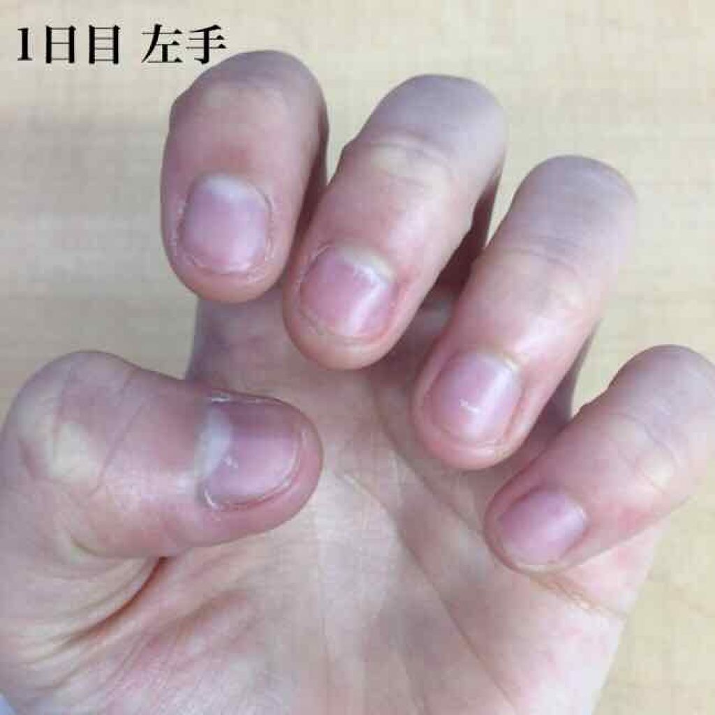 ピンクピンク on LIPS 「私は爪を噛んでしまうという癖が小さい頃からあります!しかし、も..」(1枚目)