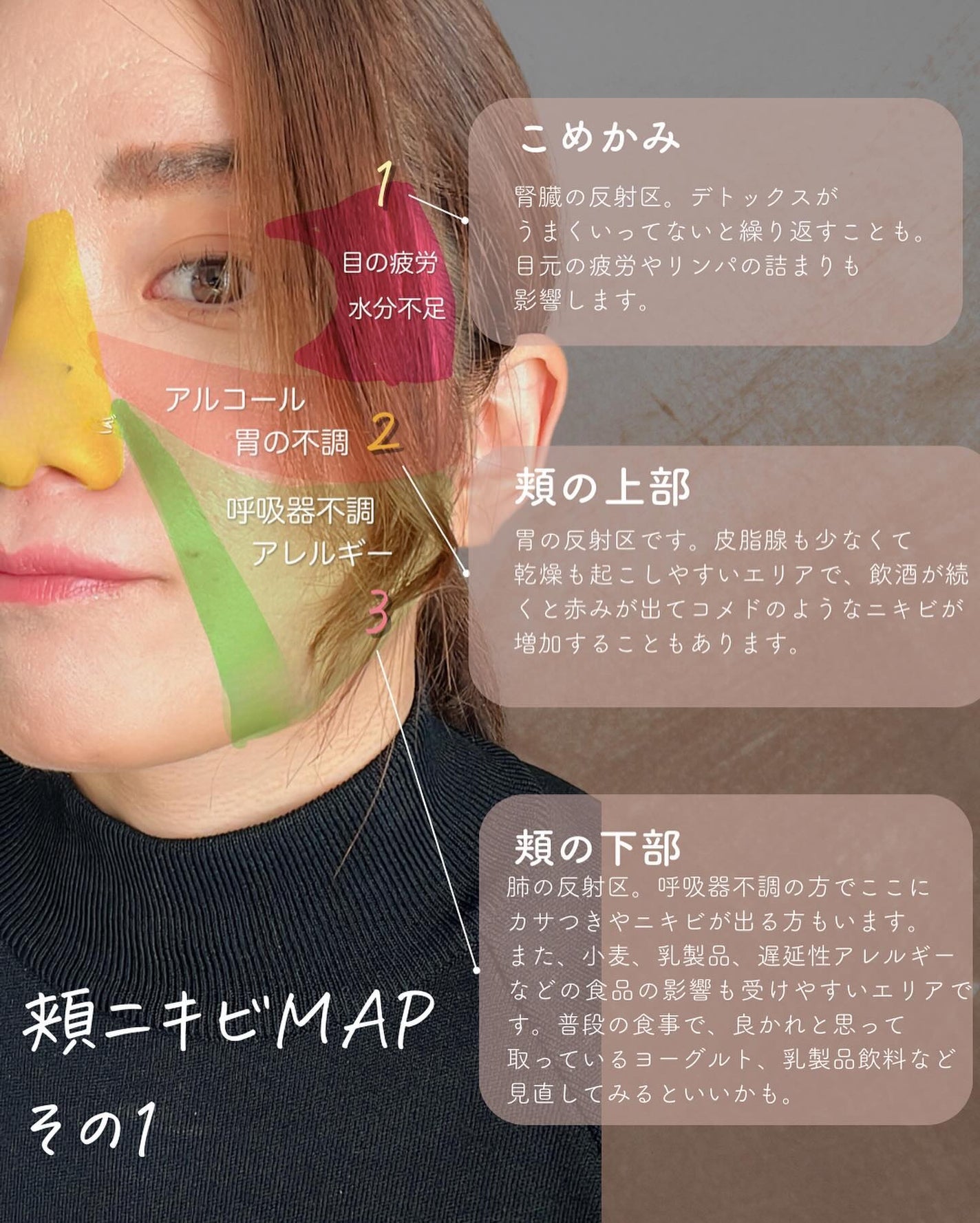 おゆみ|ニキビ・ニキビ跡ケア on LIPS 「【頬ニキビ原因MAP〜最も潰されてしまいがちなニキビ達〜】こん..」(3枚目)