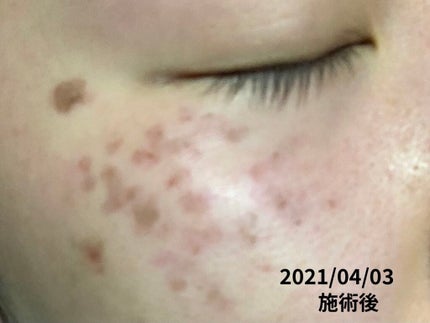 を使ったクチコミ(2枚目)