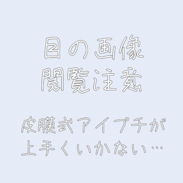 こんにちは、ユウです～(›´ω`‹ )

写真2枚目～4枚目が皮膜式アイプチ使用時、5枚目が何もしていない目で、6枚目が何もしていない目で上を向いた時(謎の線)、7枚目が奥二重の線を写したものです

オ