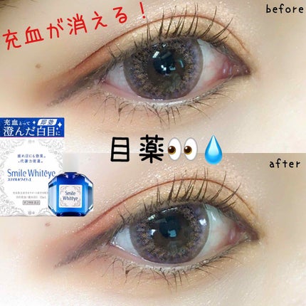 スマイルホワイティエ(医薬品)/ライオン/その他を使ったクチコミ(1枚目)