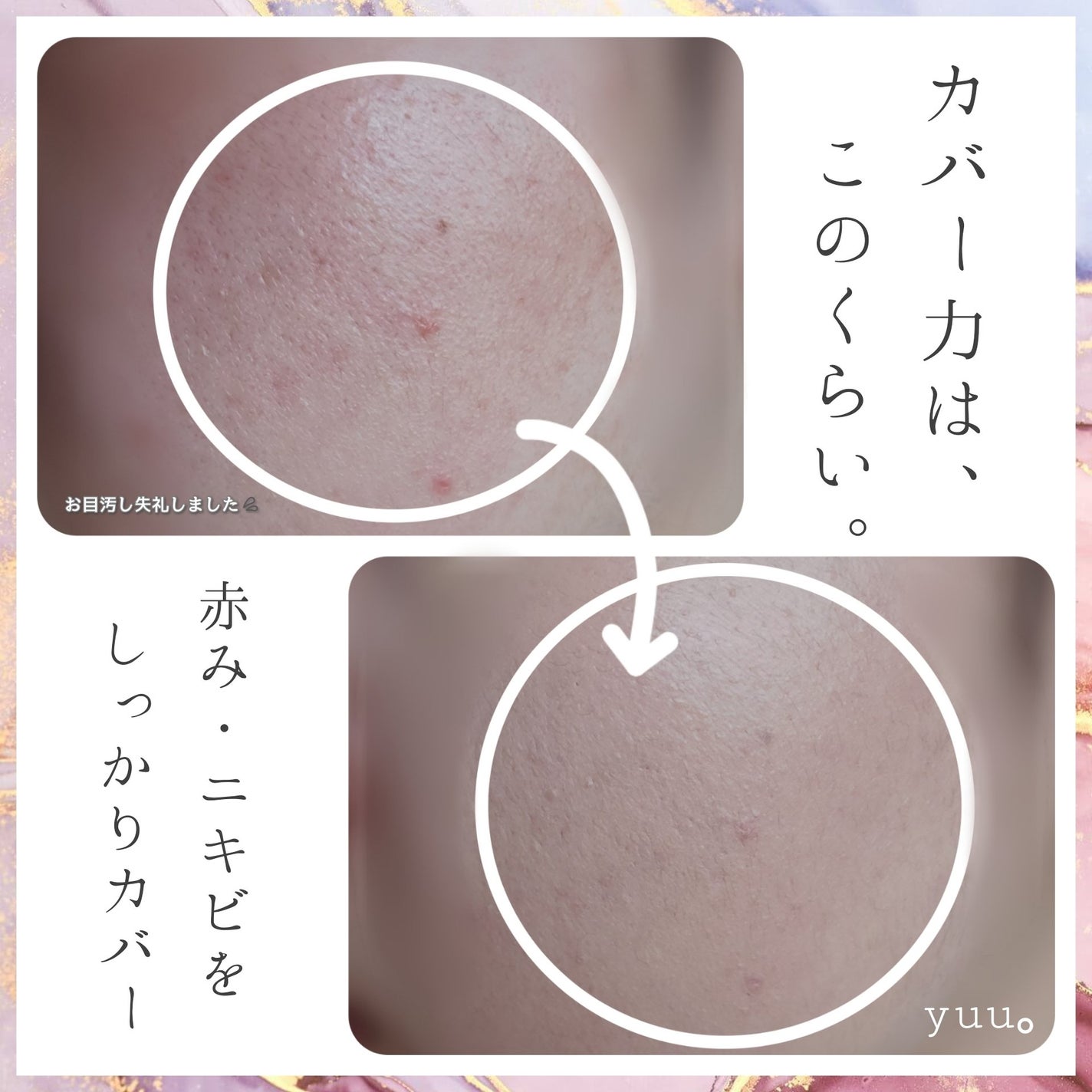 ピンクティーツリーカバープライマークッション/APLIN/クッションファンデーションを使ったクチコミ(7枚目)