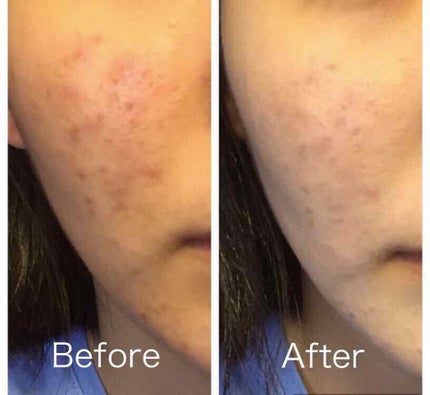 ブライトピュアベース/CandyDoll/化粧下地を使ったクチコミ(3枚目)