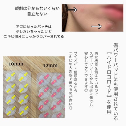 キャッチミーパッチ/CATCH ME PATCH/にきびパッチを使ったクチコミ(2枚目)