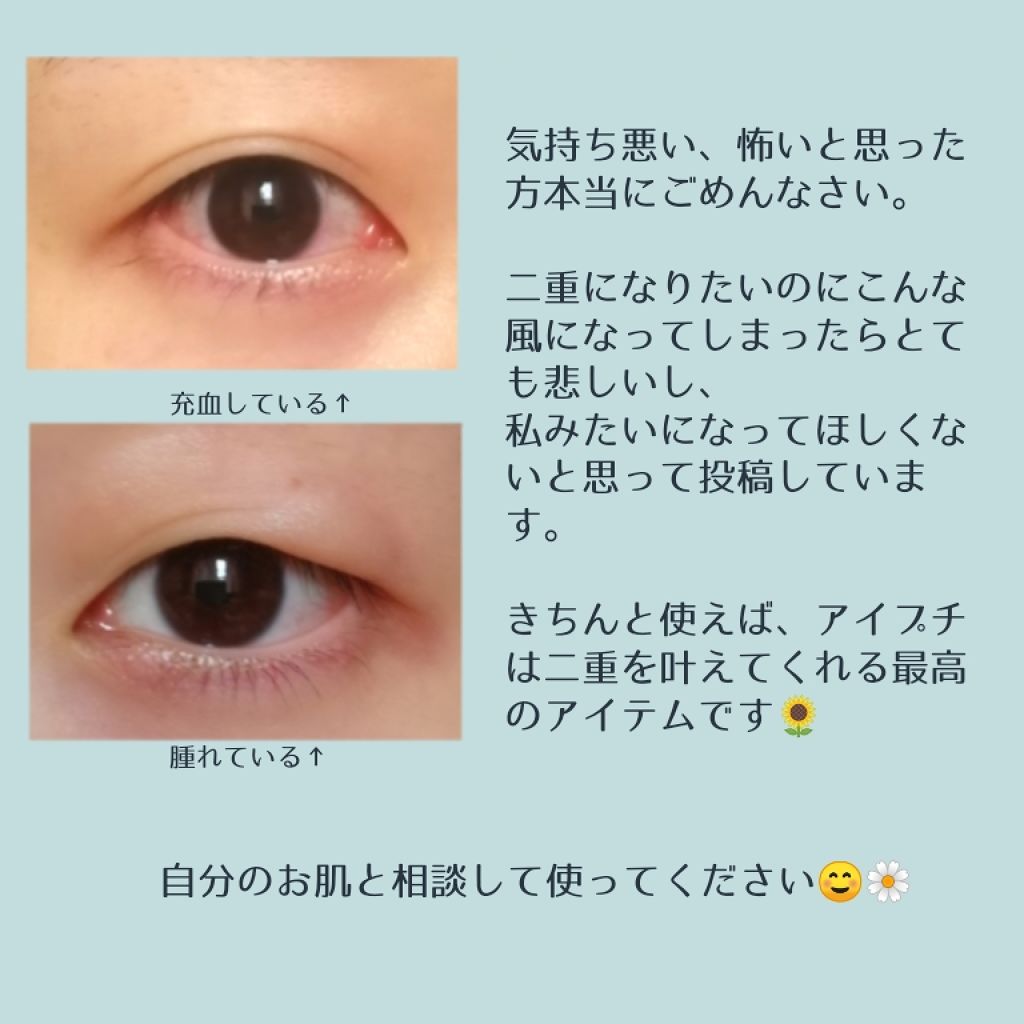 アイトーク クリアジェル アイトークの口コミ アイプチ初心者さん 敏感肌さんへアイプチで By ちはる 心を込めて投稿 敏感肌 Lips