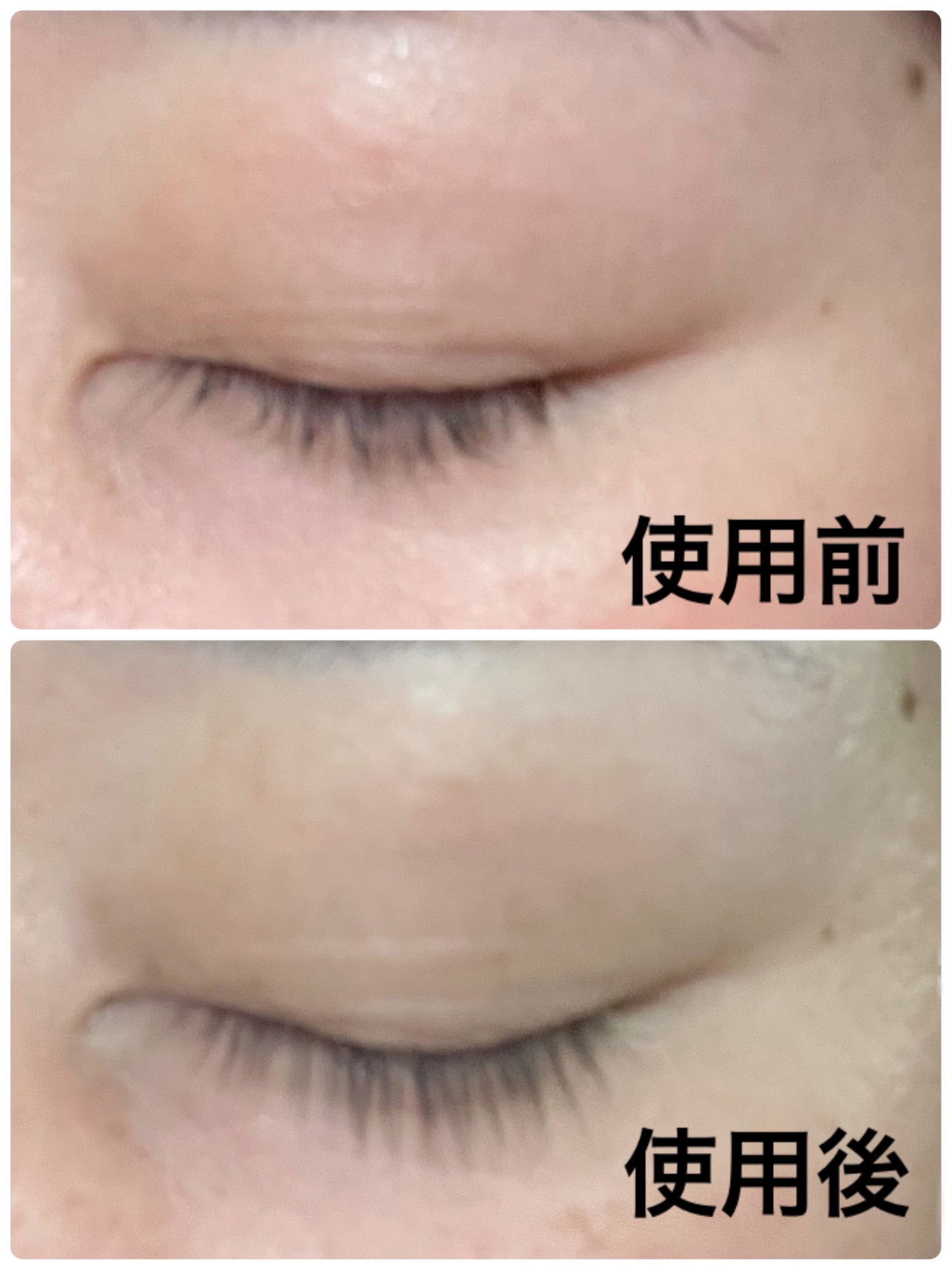 湘南美容まつ毛美容液/Co-medical+/まつげ美容液を使ったクチコミ(5枚目)