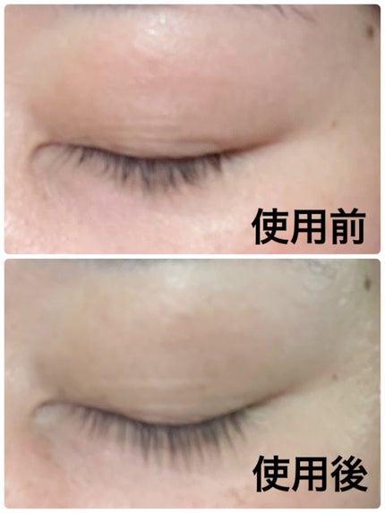 湘南美容まつ毛美容液/Co-medical+/まつげ美容液を使ったクチコミ(5枚目)