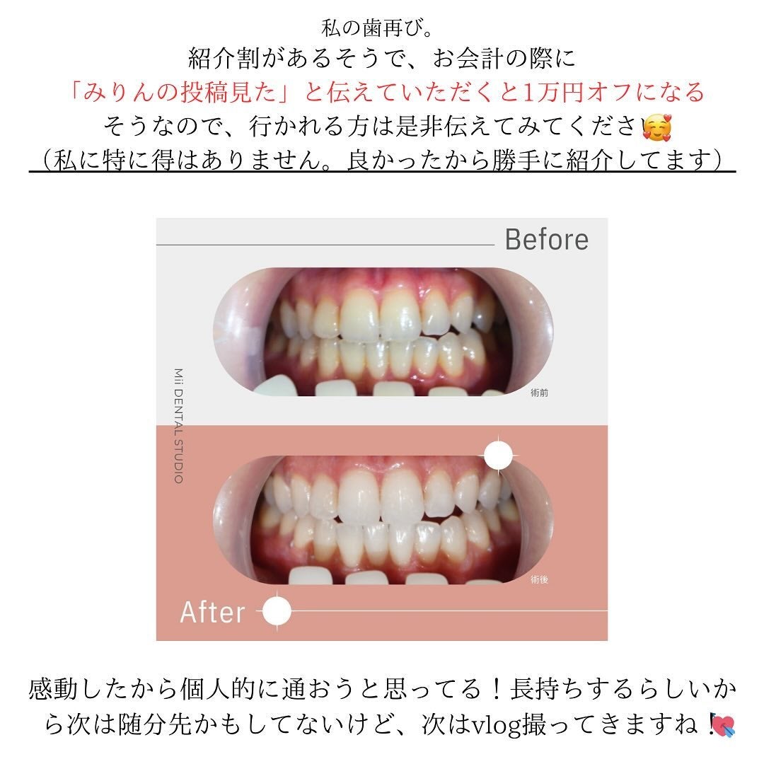 みりん on LIPS 「『歯は顔面にくっついてる宝石』だと思っている私🦷💎定期的なホワ..」(8枚目)