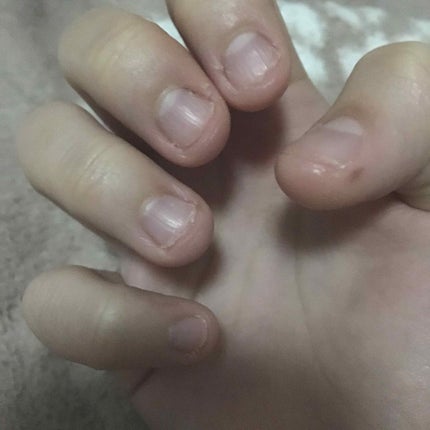 AC キューティクルオイル/AC MAKEUP/ネイルオイル・トリートメントを使ったクチコミ(3枚目)