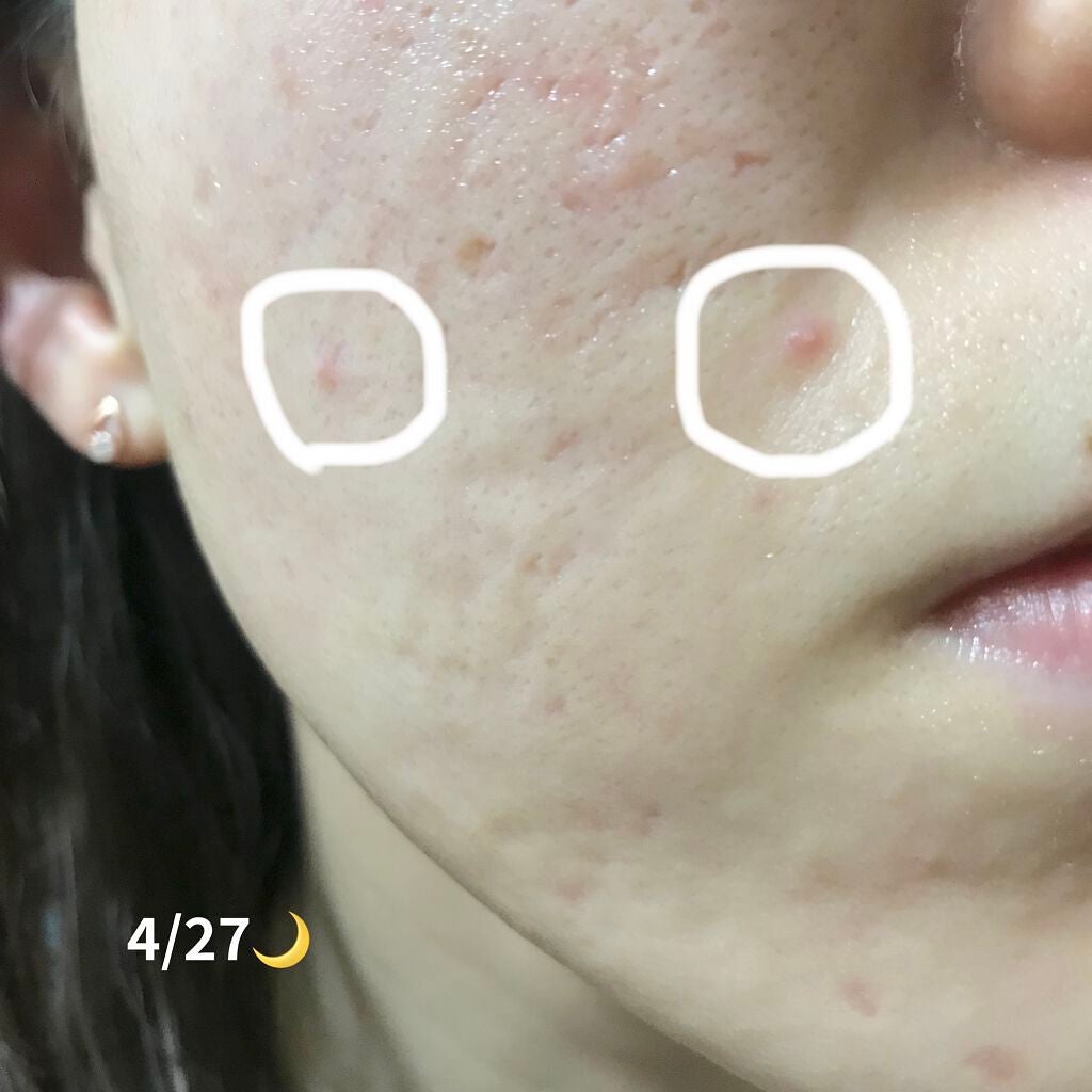 Cサスペンション23+HAスフィア2フェイスクリーム/The Ordinary/美容液を使ったクチコミ(3枚目)