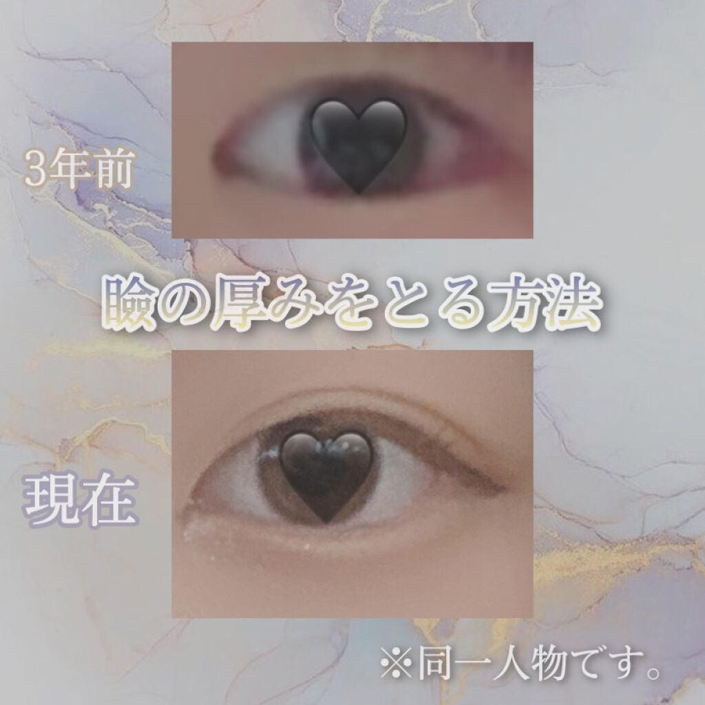 アクティブアイトークII/アイトーク/二重まぶた用アイテムを使ったクチコミ(1枚目)