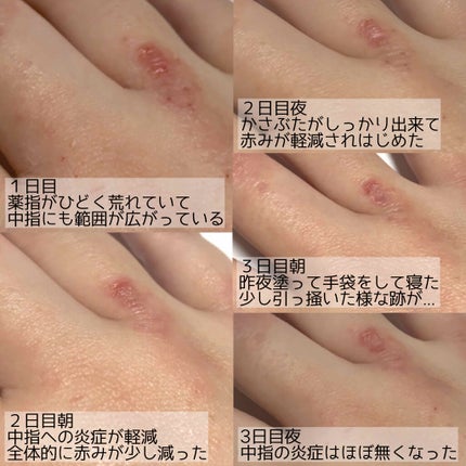 白色ワセリン(医薬品)/日本薬局方/その他を使ったクチコミ(8枚目)