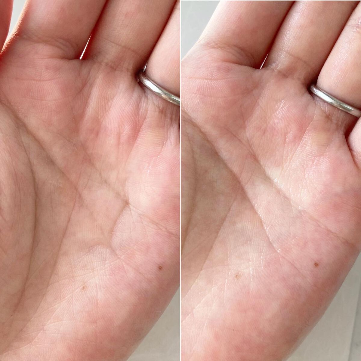 エッセンス/タッチャ/化粧水を使ったクチコミ(6枚目)