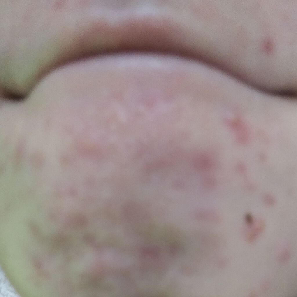 潤い化粧水/ももぷり/化粧水を使ったクチコミ(3枚目)