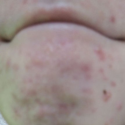 潤い化粧水/ももぷり/化粧水を使ったクチコミ(3枚目)