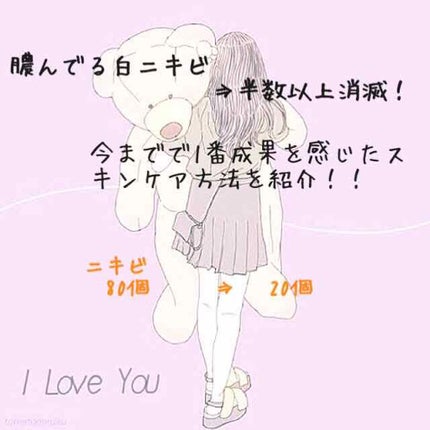 ããã ã®ä¿æ¹¿ãžã§ã«(ããã¥ãªãš ã¹ãã³ã³ã³ãã£ã·ã§ãã³ã°ãžã§ã«)/ããã¥ãªãš/çŸå®¹æ¶²ã䜿ã£ãã¯ãã³ãïŒ1æç®ïŒ