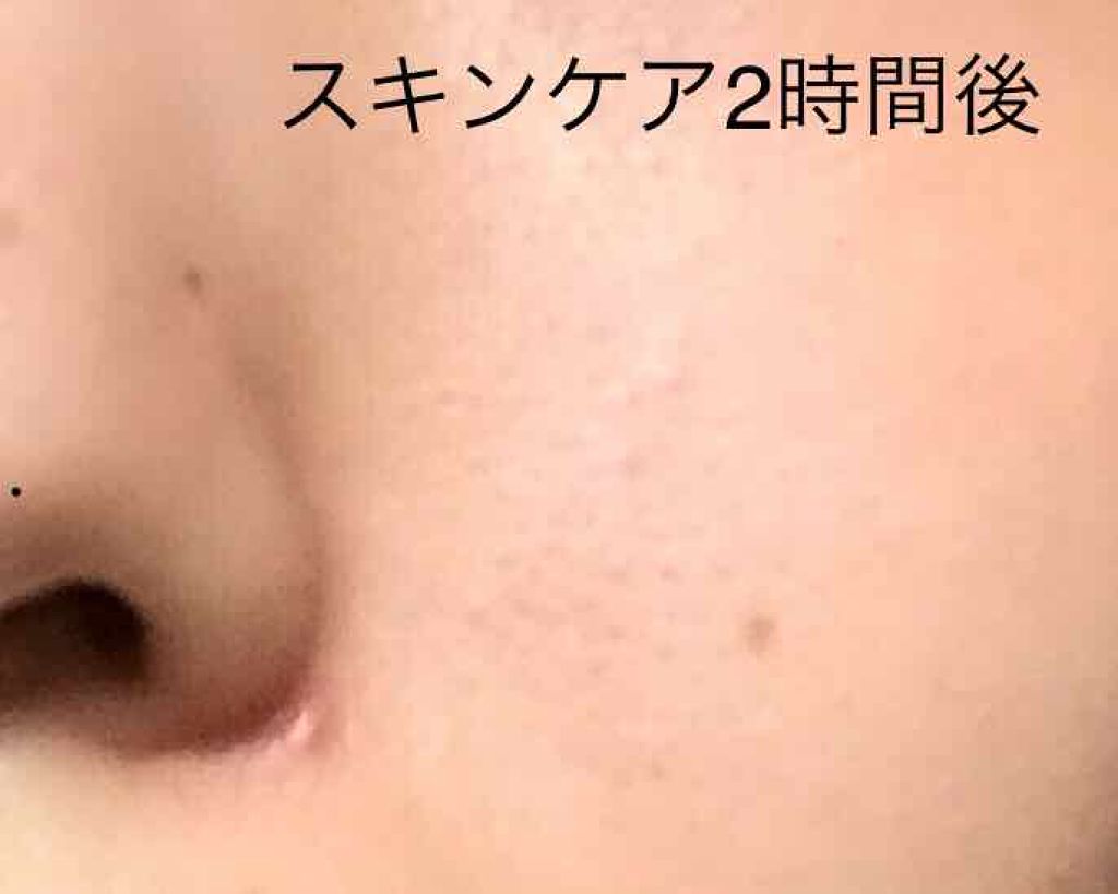 日本酒の化粧水/菊正宗/化粧水を使ったクチコミ(4枚目)