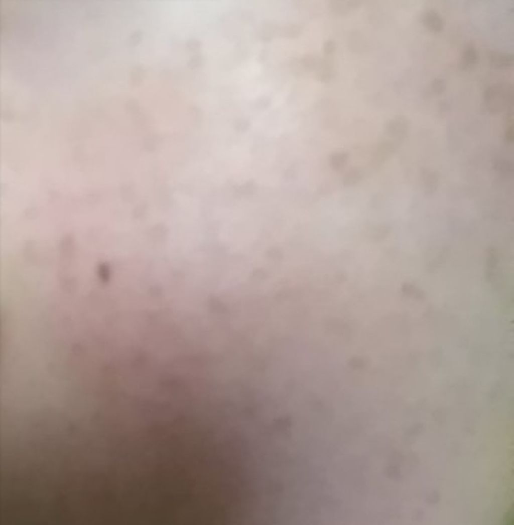 薬用美白 美容液/DAISO/美容液を使ったクチコミ（3枚目）