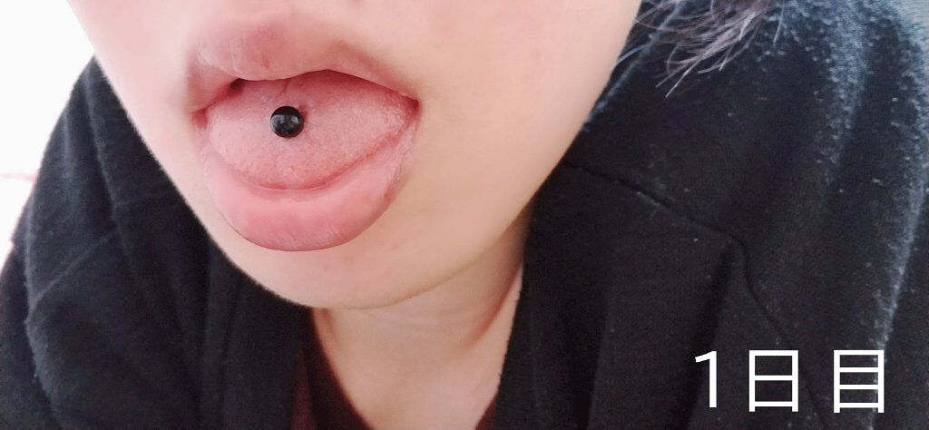 クリアクリーン プラス 薬用デンタルリンス/クリアクリーン/マウスウォッシュ・スプレーを使ったクチコミ(2枚目)