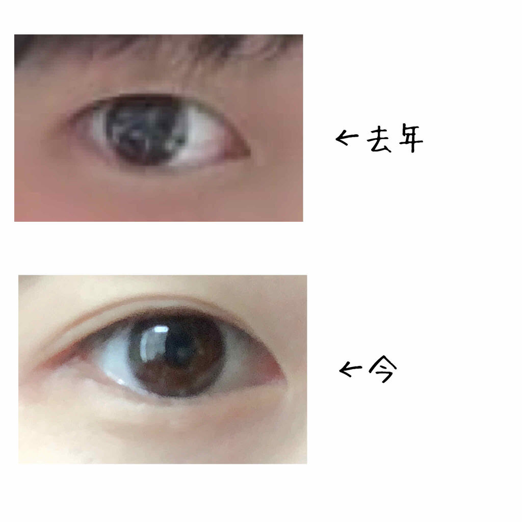 のびーるアイテープ（絆創膏タイプ、レギュラー）/DAISO/二重まぶた用アイテムを使ったクチコミ（2枚目）